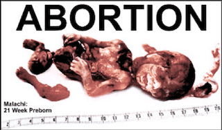 14 Abortion